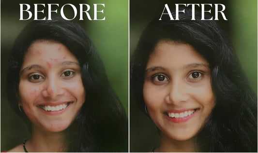 Vedhascents -Aqua Leaf-Premium Natural Face Wash|Best Face Wash for Oil, Acne & Pimple Control|Deep Cleansing & Glow Boosting-100ml